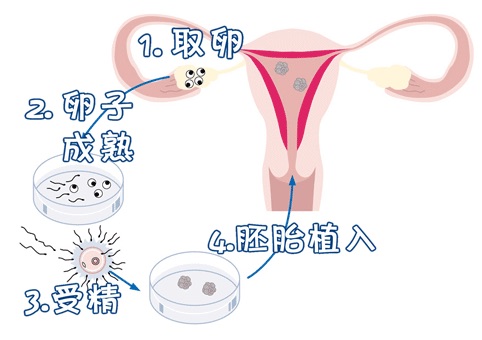 优胚鲜胚移植医学中心